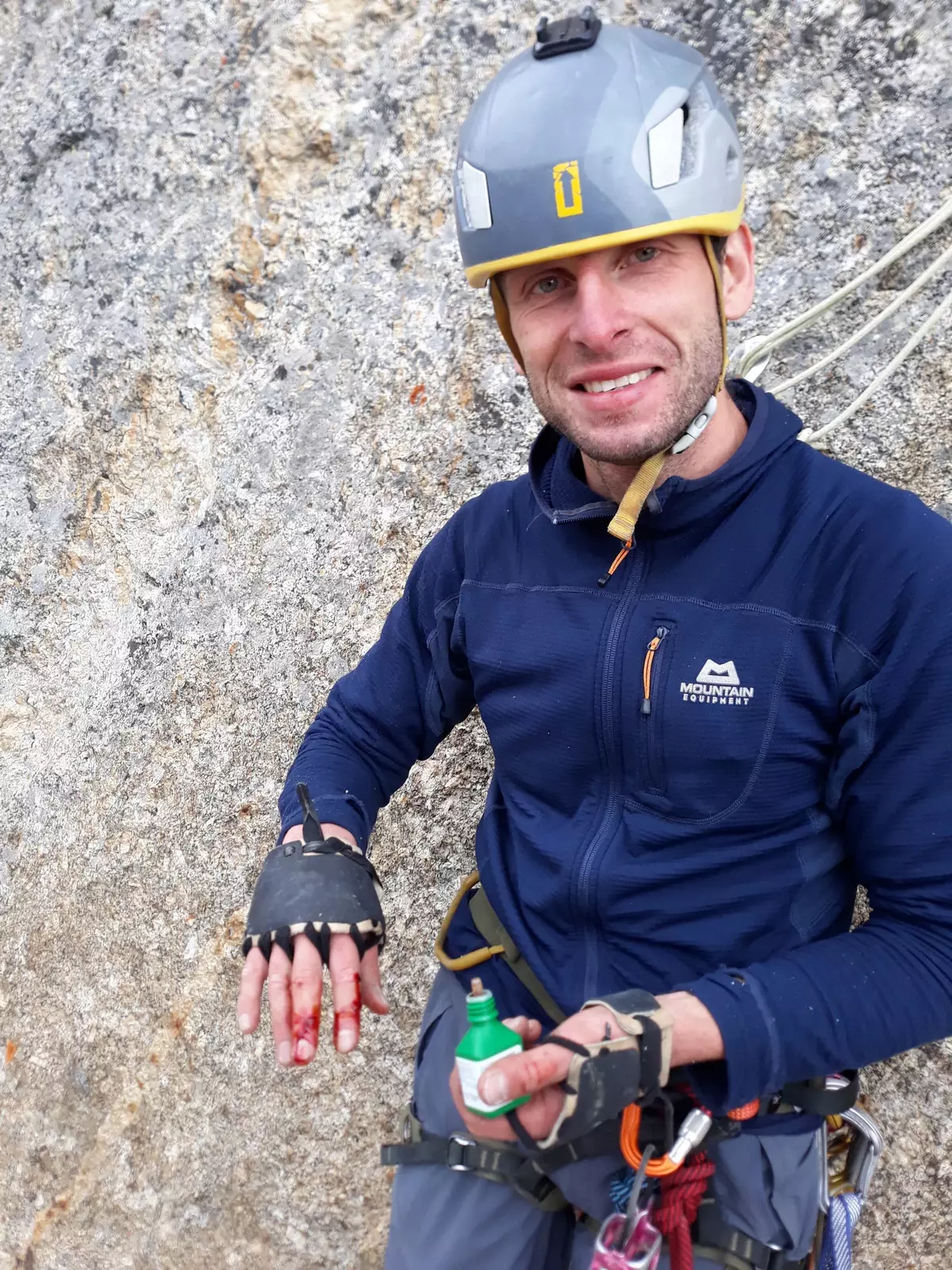 Goša si ošetřuje ruku a ještě se tomu směje