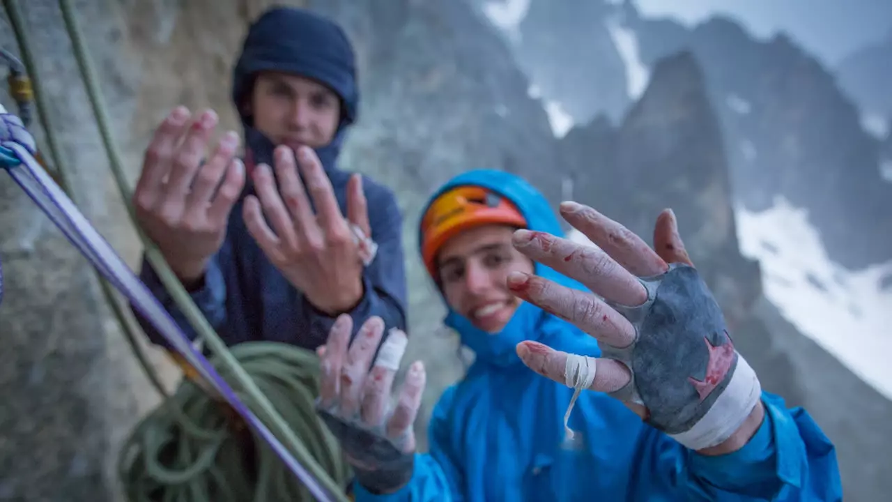 Franta s Ondrou si s sebou z cesty odnášejí i bolavou památku. Autor fotografie: www.stanislavmitac.com